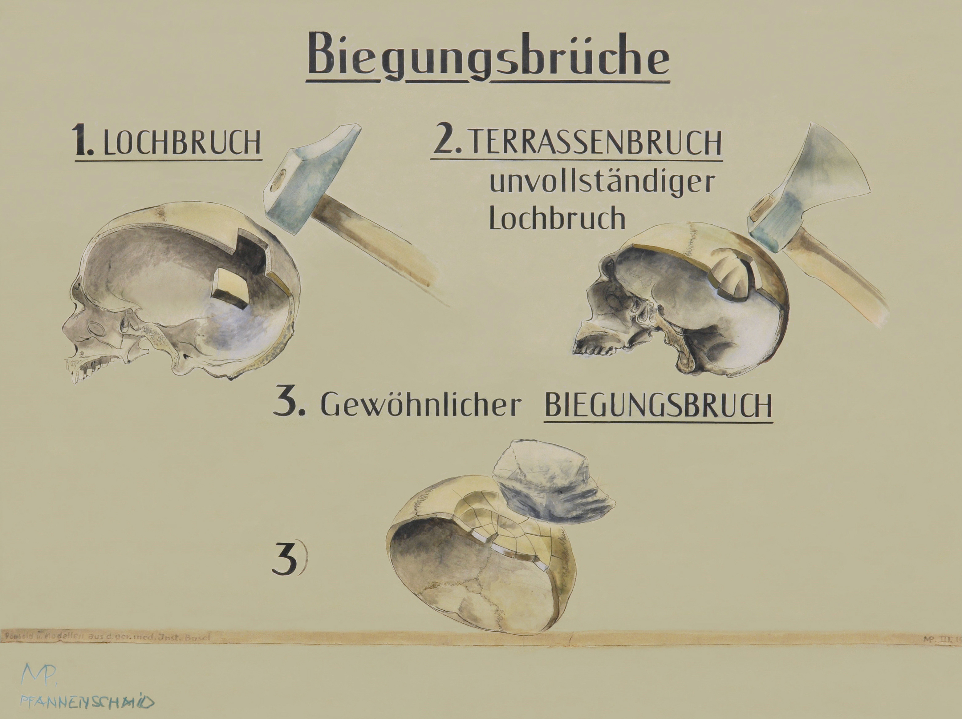 Martha Pfannenschmid, Lehrtafel © IRM Basel Martha Pfannenschmid, Lehrtafel © IRM Basel