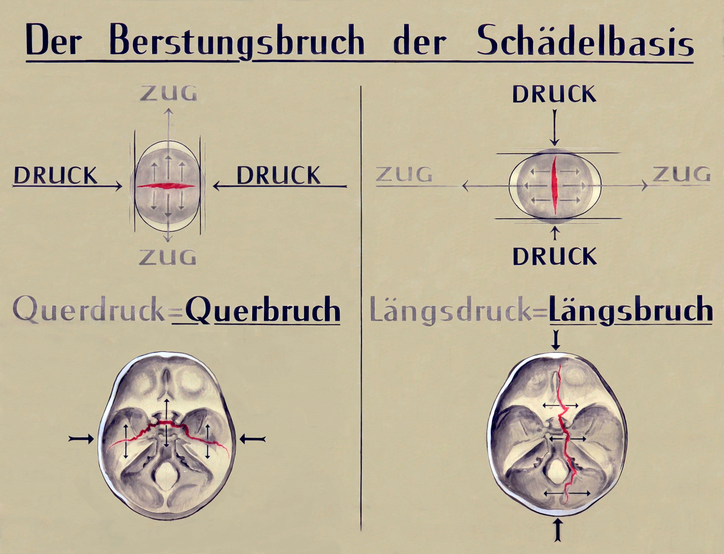 Martha Pfannenschmid, Lehrtafel © IRM Basel Martha Pfannenschmid, Lehrtafel © IRM Basel