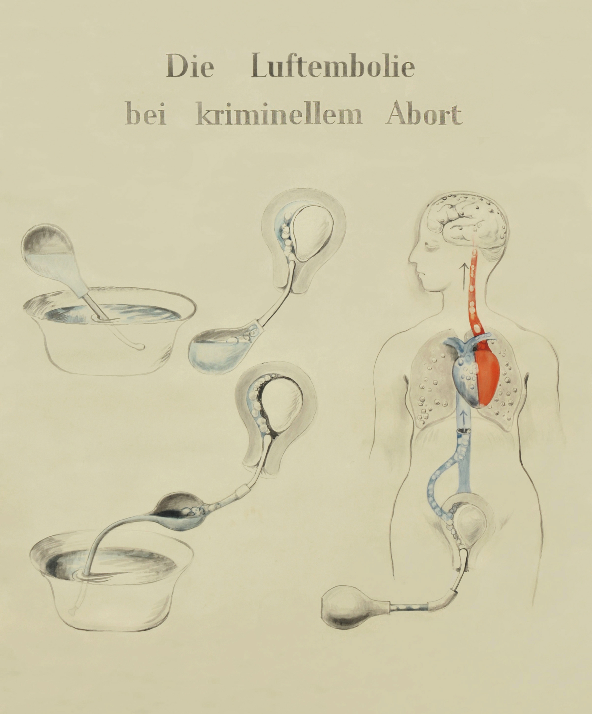 Martha Pfannenschmid, Lehrtafel &copy; IRM Basel